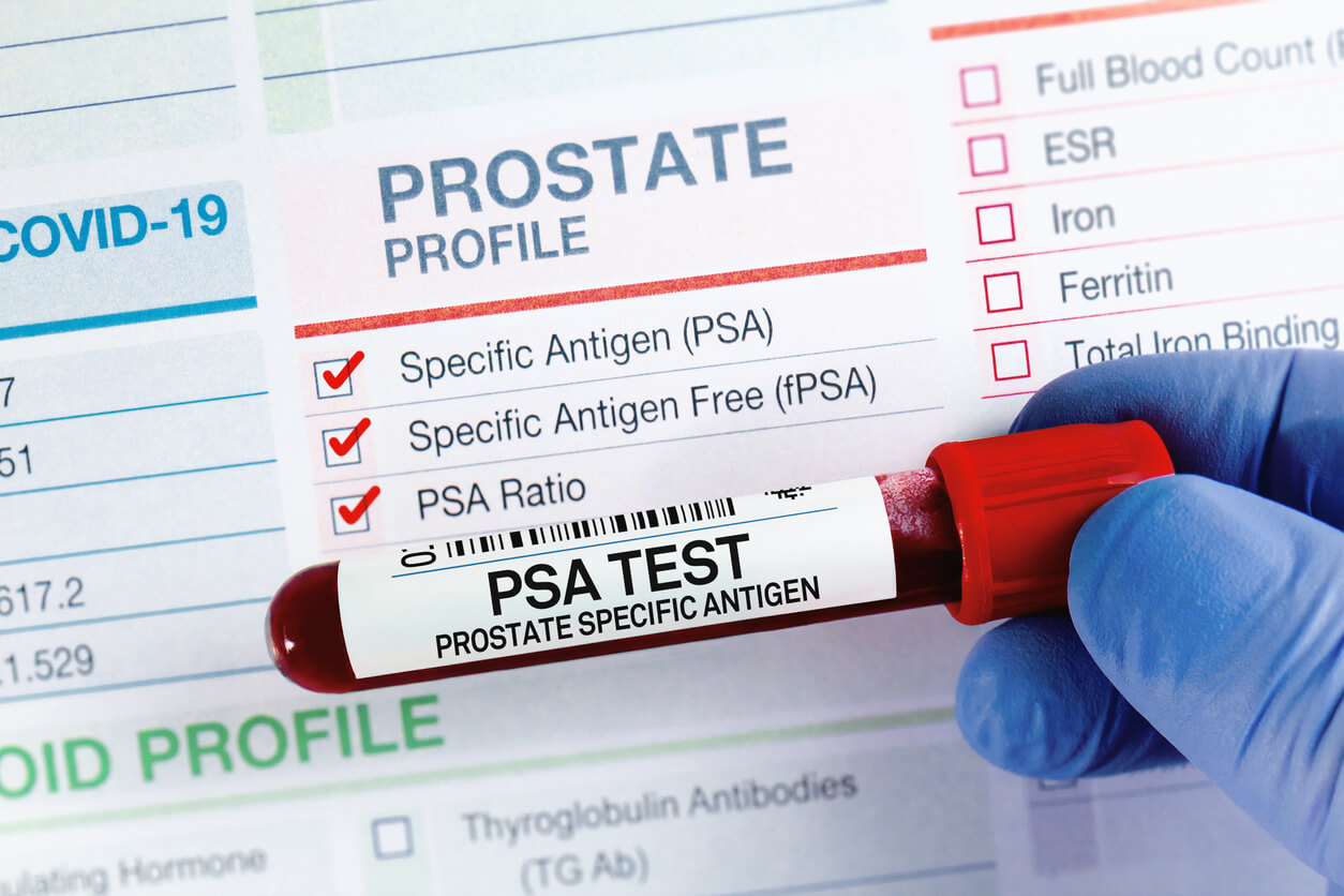 What is Elevated PSA?